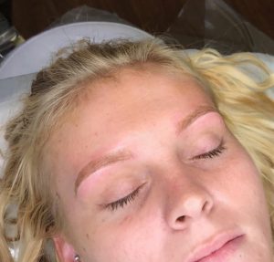 Eyebrow treatment