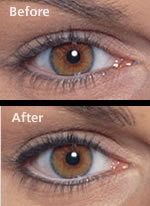 Permanent Make Up Eyeliner Before & After Pictures