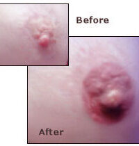 permanent cosmetic makeup areolas